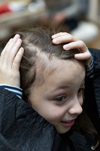 hair loss treatments for children hair loss clinic Dorset